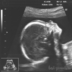 беременность 19 недель фото УЗИ