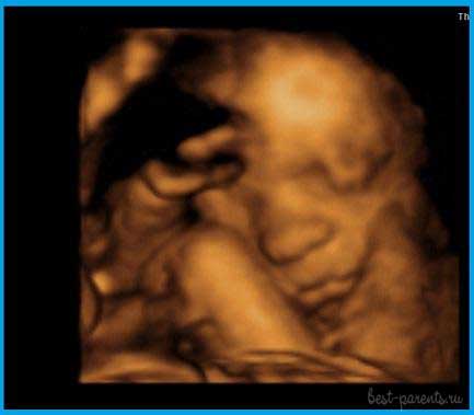 фото УЗИ 27 недель беременности