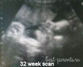 УЗИ 32 недели беременности фото