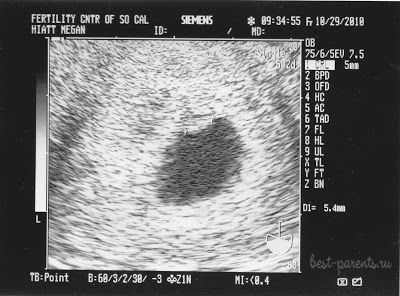 УЗИ 6-7 недель беременности